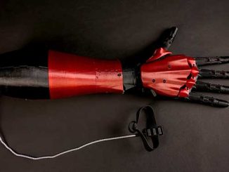 MV VCAA Affordable Lightweight Multiarticulate Myoelectric Prosthetic Arm by Christopher Batras photo by Nicole Cleary